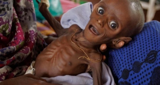  BM: 400 bin çocuğa acil yardım gerek